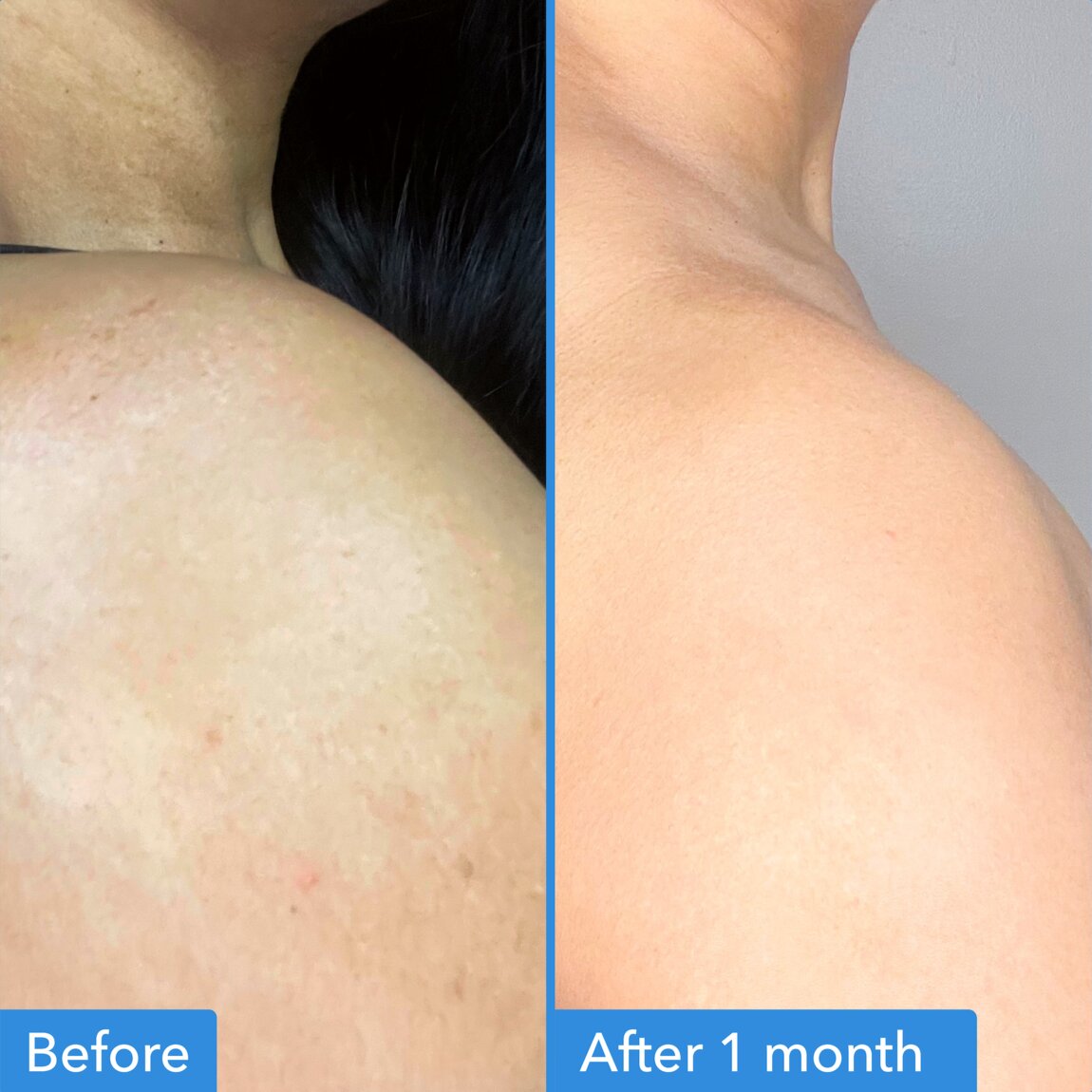 discoloration-correcting-body-treatment-l8 zb_p.jpg