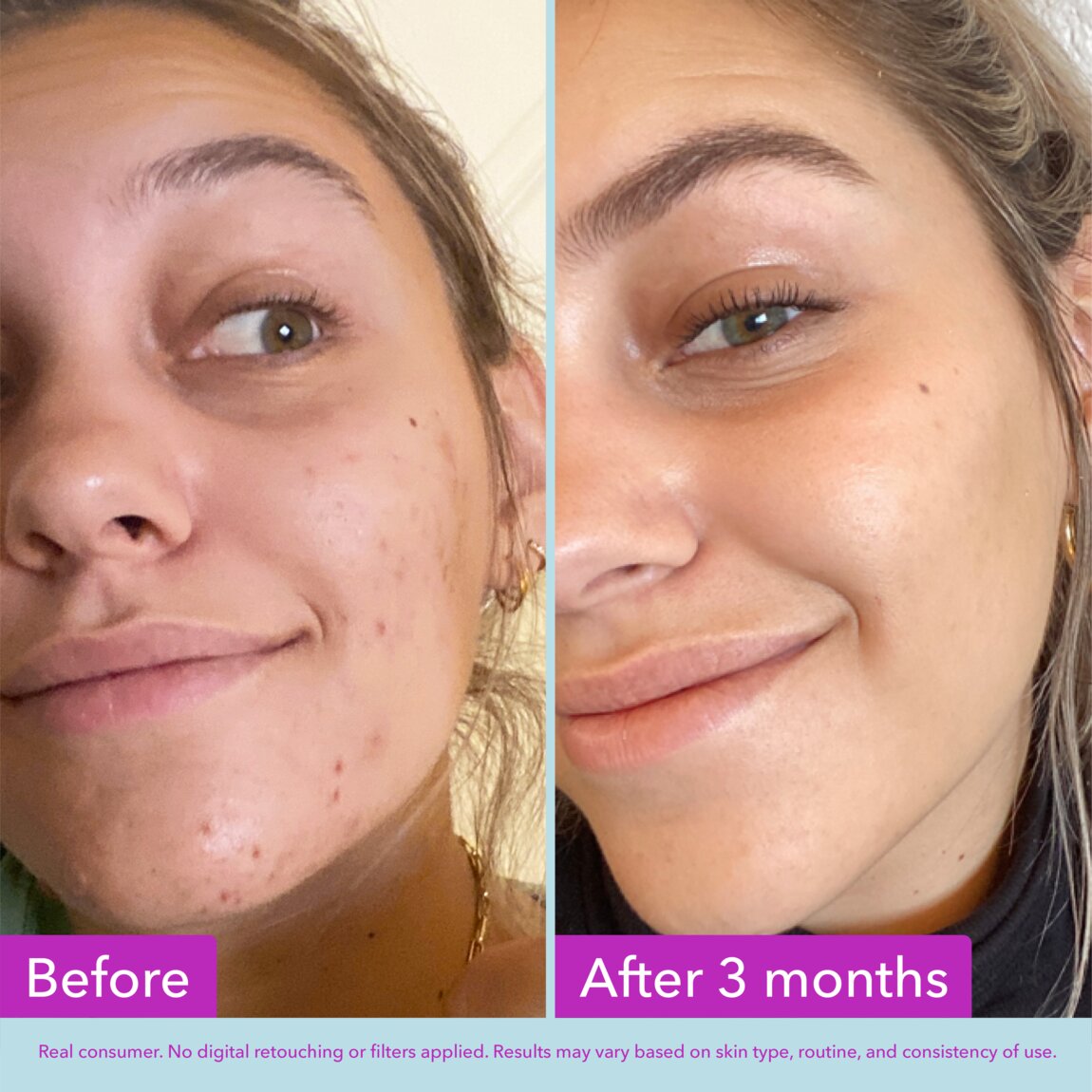 niacinamide-brightening-toner-z3 zb_p.jpg