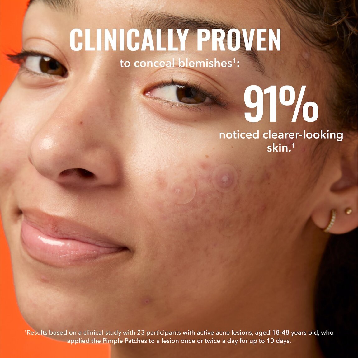 pimple-patches-i8 zb_p.jpg