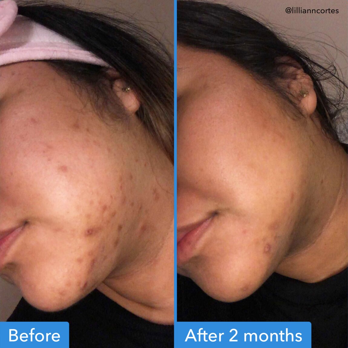 discoloration-correcting-serum-n5 zb_p.jpg